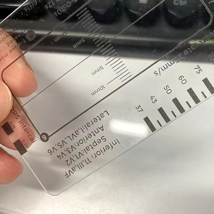 Ruler - Heartbeat ECG Observation 7 Steps