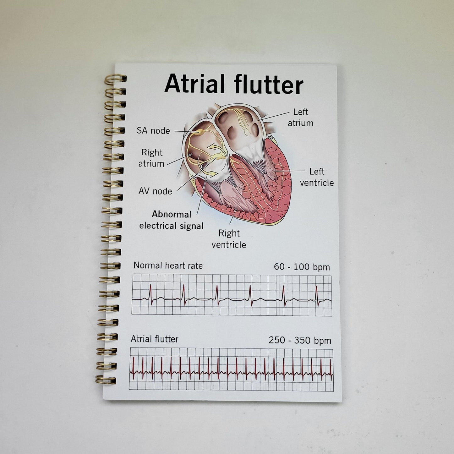Notebook - Atrial Flutter