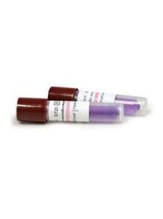Monitoring, Sterilization Indicators, Biological, 24 Hours, Steam