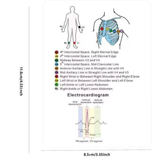 Medical Flashcards – ECG Rhythm and Ecliptical Syndrome (12 cards)