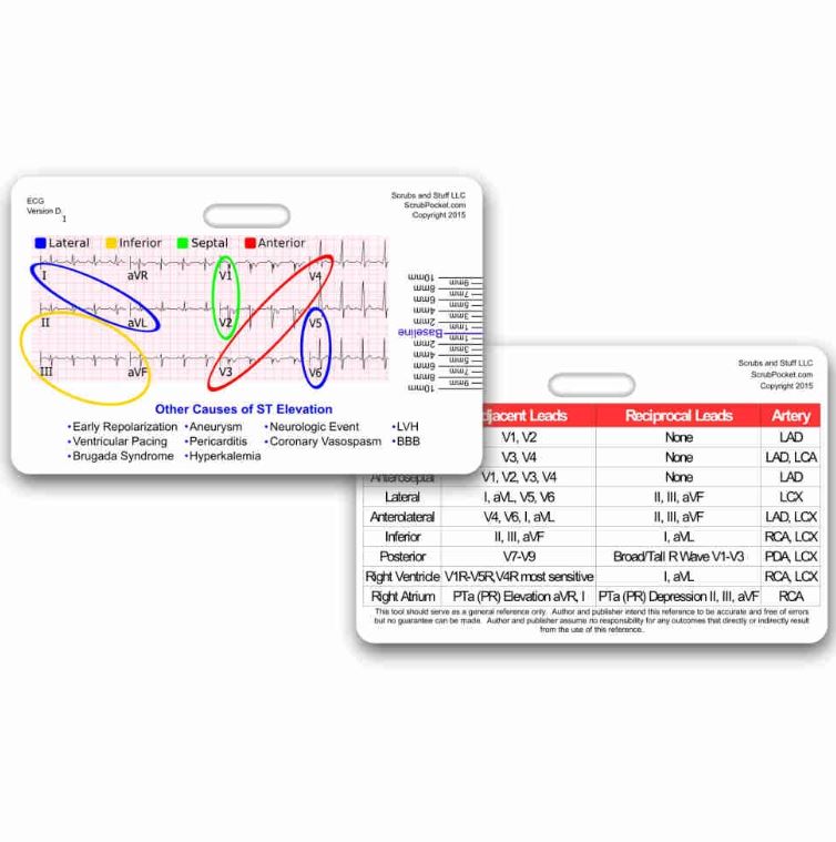 Stemi Alert Reference Chart Reference Card - Stemi Tool w/ Vessel Chart | ShaGha