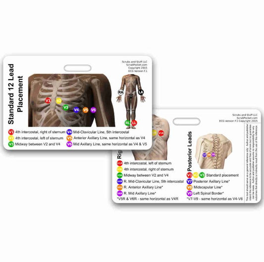 Reference Card - EKG Placement